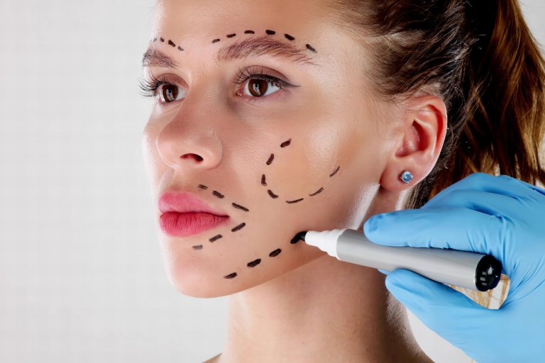Lifting Facial en Nicaragua
